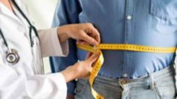 First obesity management service to be launched in NI