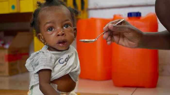 'Without this hospital, they would be dead': The staff crossing gang lines to battle malnutrition and cholera in Haiti capital