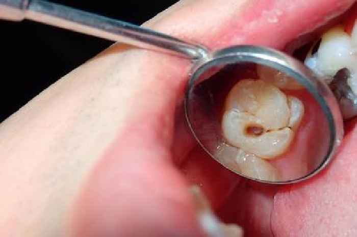 Devon's dental collapse forces pensioners abroad and kids into pain