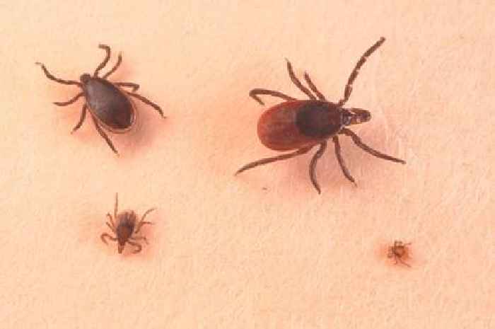 'I'm an A&E doctor and you need to do this urgently if you get bitten by a tick'