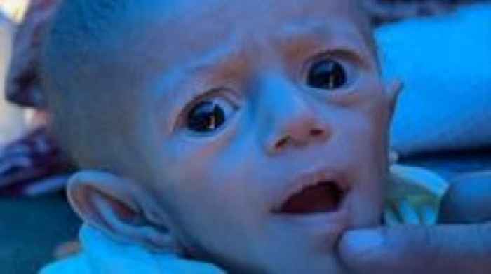 'Situation is dire' - BBC returns to Gaza baby left hungry by Israeli blockade
