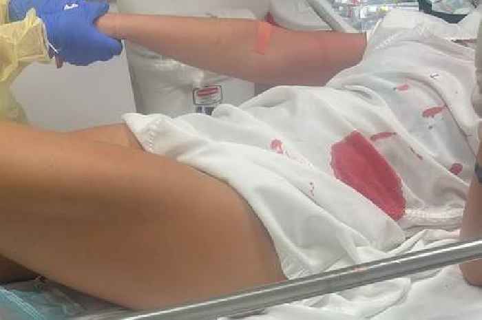 British Woman suffers shark attack on holiday in Jamaica