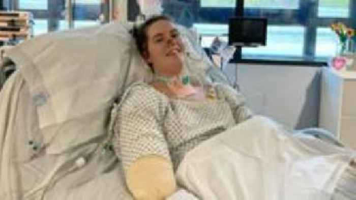 Jersey business to hold concert for sepsis amputee