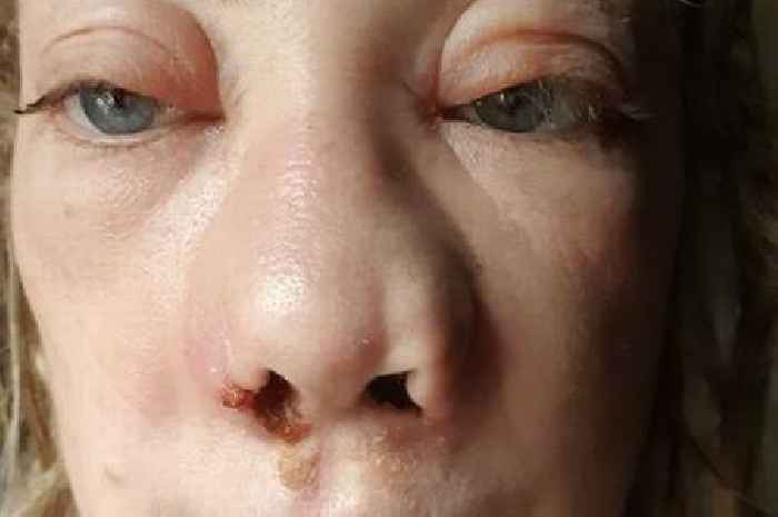 Mum in 'worst pain of life' after botched Turkey teeth saw face collapse