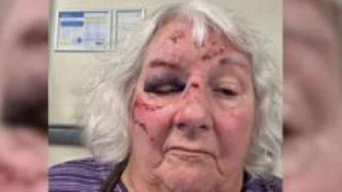 Uneven pavements causing injury and isolation