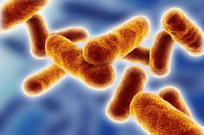 One dead and three seriously ill in anthrax outbreak as WHO alerted