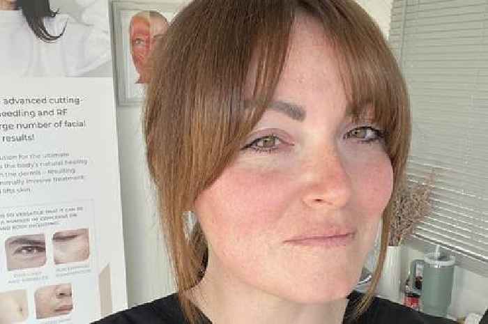 'Hairdresser saved my life with advice on hidden scalp mole that was cancer'
