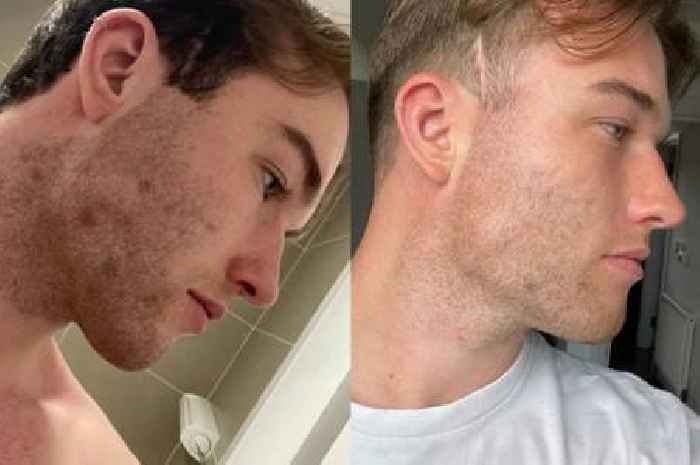 Nan's letter with pot of cream cleared man's skin in four days and inspired skincare brand