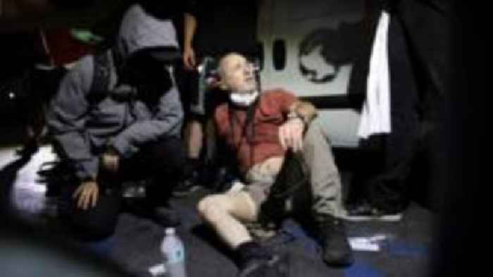 British photographer injured by 'plastic' bullet