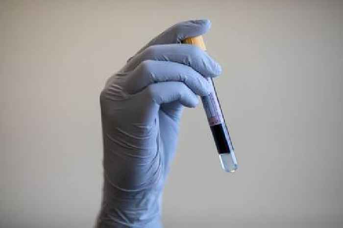 Vampire facial clients urged to get tested as 'risk' identified at Wolverhampton aesthetics clinic