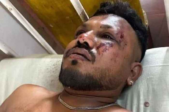 Air India crash survivor speaks about escape as doctors reveal full list of injuries