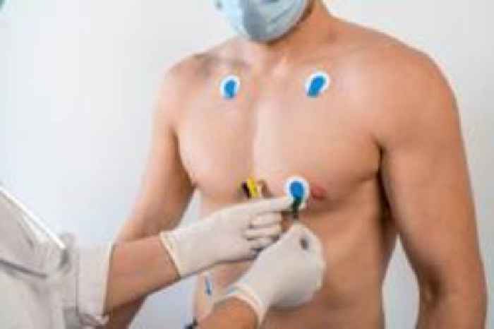 AI 'provides early diagnosis' of heart problems