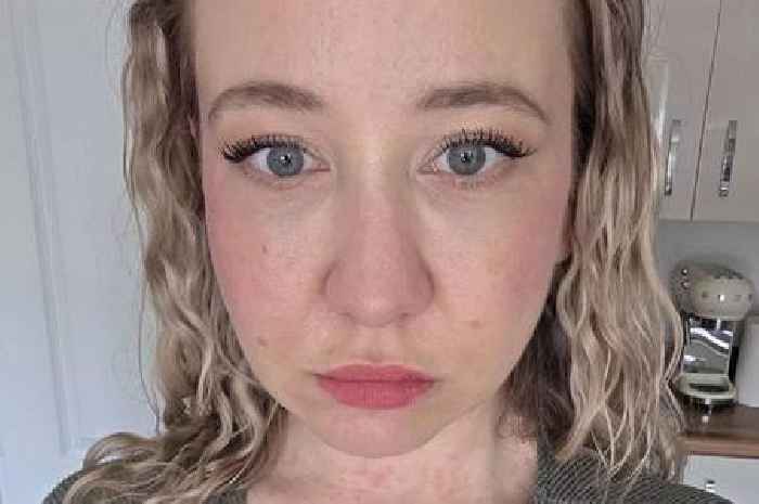 Mum left with 'gruesome' rash after getting in 'dirty' hot tub on 40th birthday
