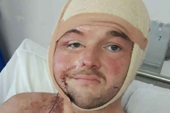 Final year Swansea University student denied master's resit despite undergoing major surgery