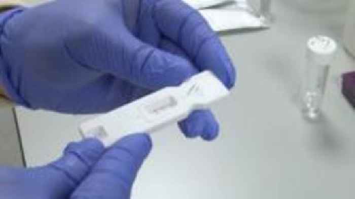 Fungal test could save people from fatal infection