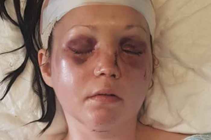 Scots mum had broken face 'pieced back together' after horror horse riding accident
