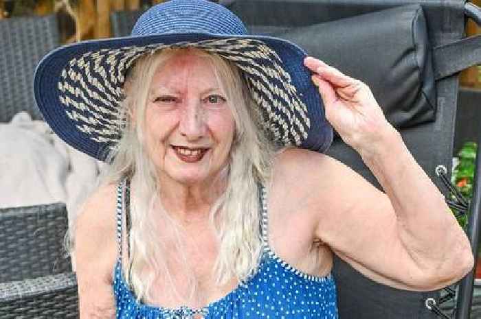 Gran left 'disfigured and unrecognisable' after falling asleep in garden