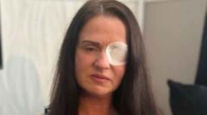 Woman left fighting for life as fake Botox beautician apologises