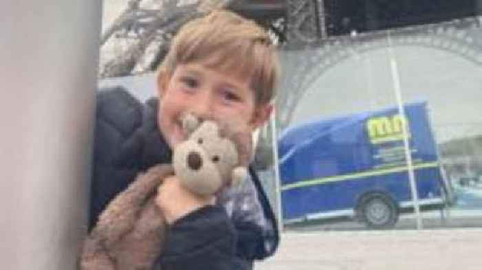 Benedict's milk allergy at 'high end of the scale'