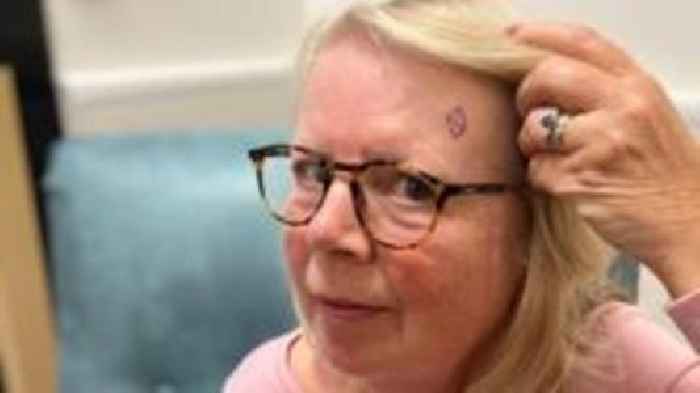'Pictures of health' cut skin cancer check waits