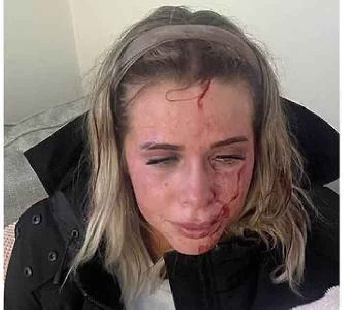 Grooming victim 'lives with trauma every day' - as force investigates crimes involving more than 700 survivors