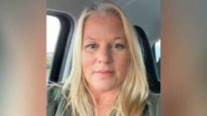 Hospital apologises after 'botched' breast surgery
