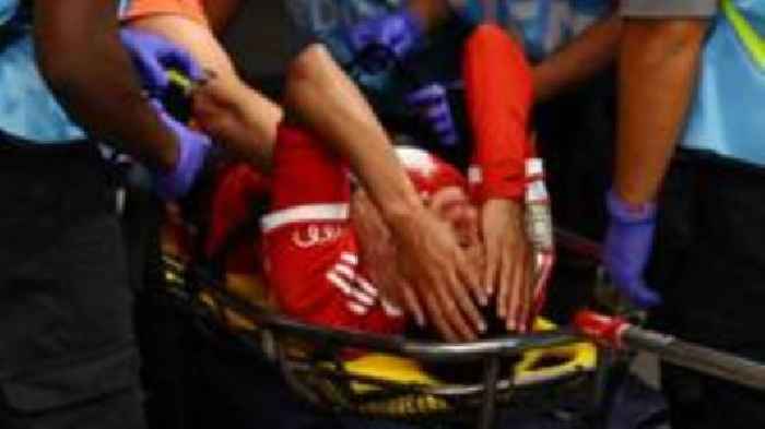 Musiala suffers broken leg and dislocated ankle