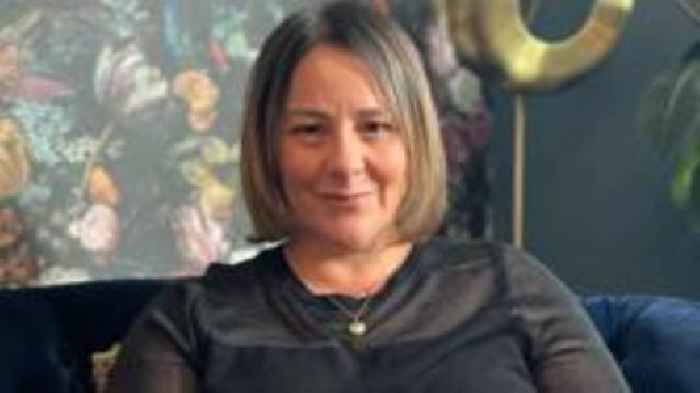 'I want my London 7/7 bombing scars to help others'