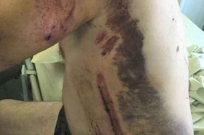 'I was struck by lightning on Friday the 13th - people thought I was dead'