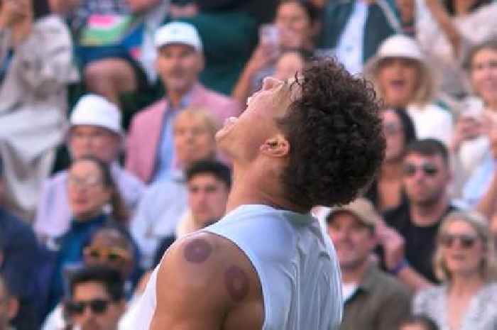 Clare Balding moves to explain strange markings on Wimbledon star's back