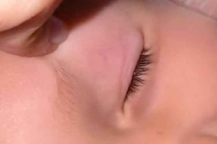 Mum spots 'something weird' on child's eye – until she discovers what it really is