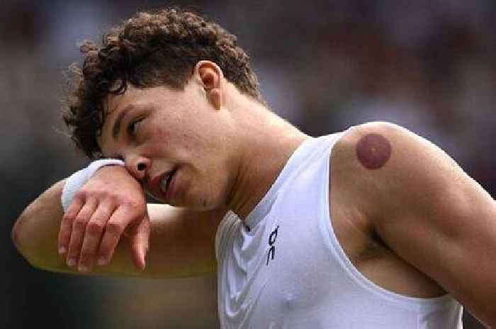 Clare Balding clears up Wimbledon confusion after spotting odd marks on star’s back