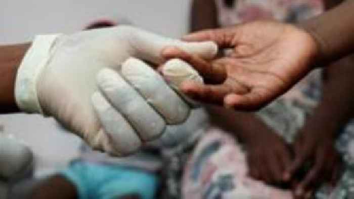 South African experts worry as US cuts to HIV treatment start to bite