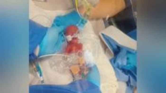 Tiny baby kept in sandwich bag dies aged 19 months