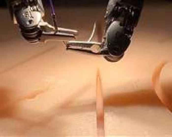 Robot autonomously completes complex surgery guided by voice and video