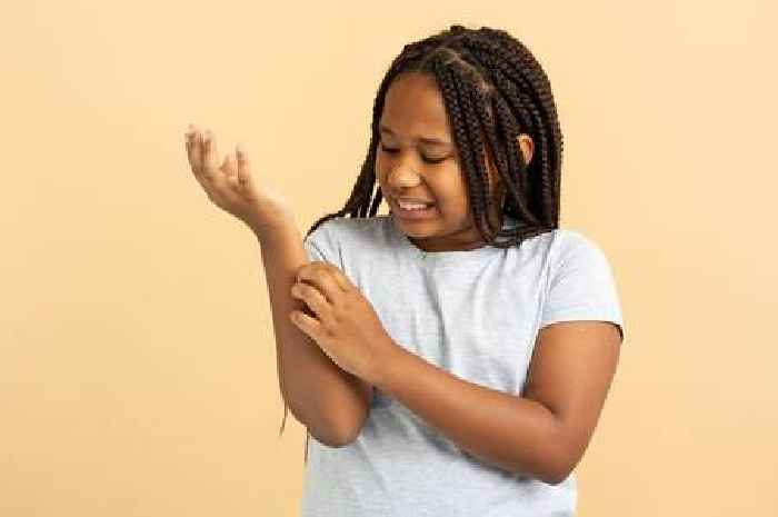 NHS warns parents of infection that makes children's skin 'feel like sandpaper'