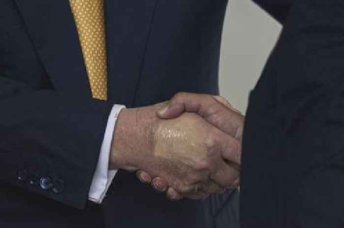 Donald Trump's health condition CVI explained after make-up on hand