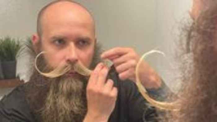 'I was bullied for my moustache, now I'm a winner'
