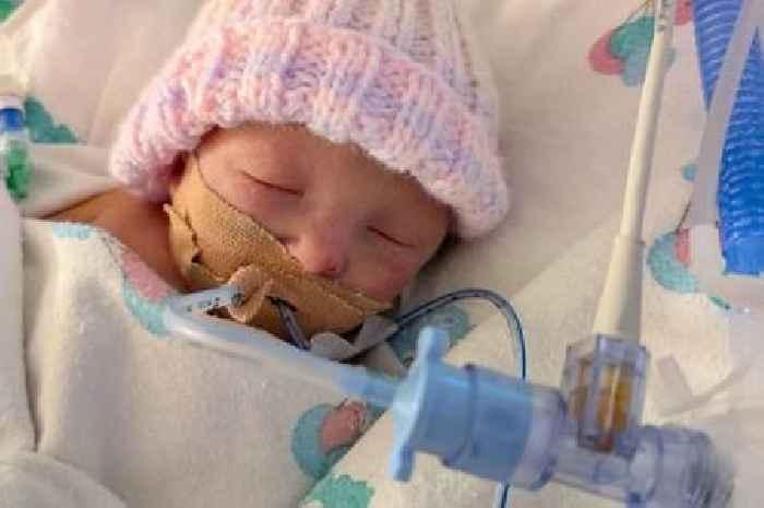 Tributes paid to 'special' baby girl with rare disease who died 9 days after birth