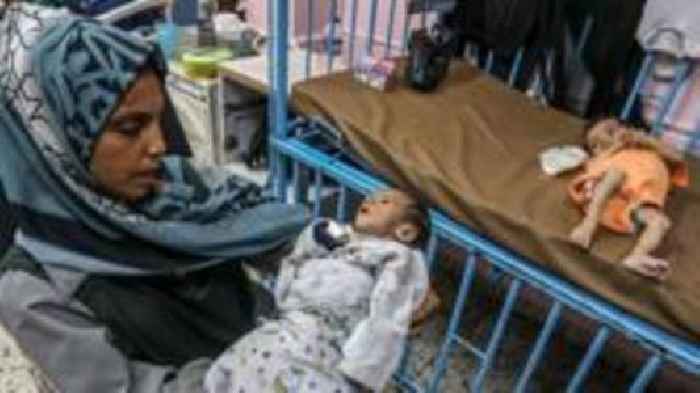 One in five children in Gaza is malnourished, UN aid agency says