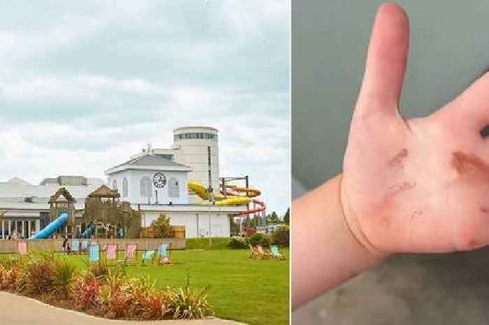 Mum's horror at Butlin's stay: Wet beds and daughter's 'poo on hands' incident