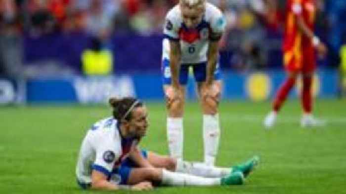 How did Bronze play Euro 2025 with fractured tibia?