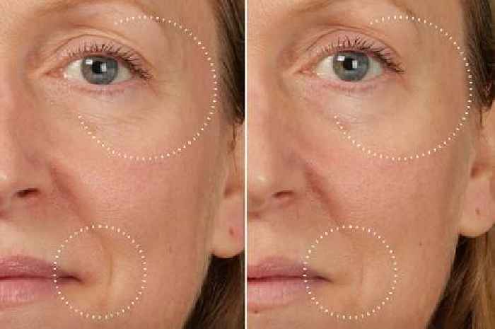Medik8 20% off sale includes 'Botox in a bottle' anti-ageing serum