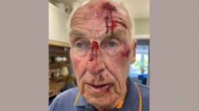 Pensioner knocked unconscious in park attack