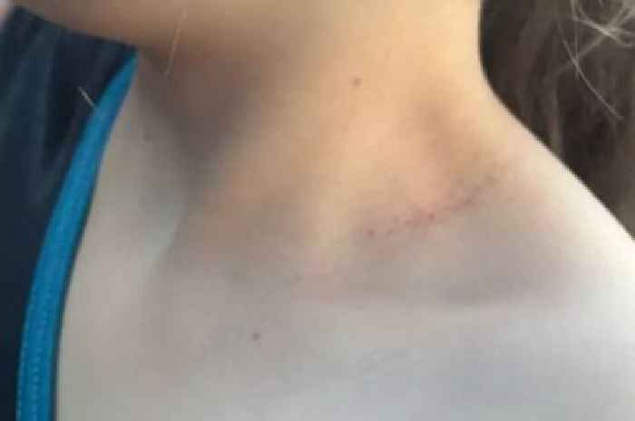 Scots mum fears as boy 'tries to strangle her daughter' at primary school