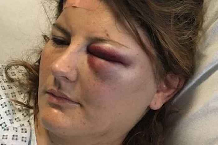 Mum-of-two had seizure driving car and nearly crashed but it was just the start of a nightmare