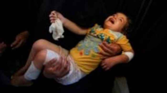 Government plans to bring more Gazan children to UK for treatment