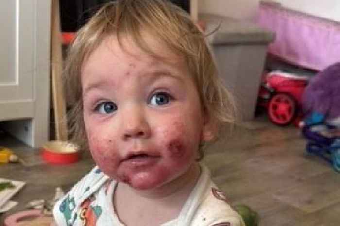 Tamworth baby boy has 'new personality' after breakthrough for painful condition