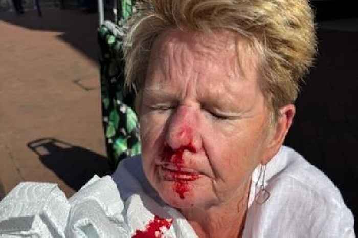 Woman bloodied in horror fall on 'unfit' Devon street