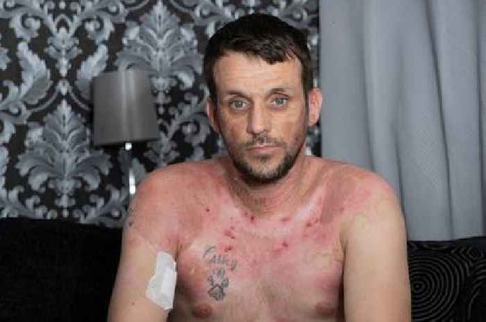 Man burned alive at horror house party fears he will 
